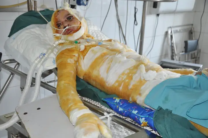 Nổ Bình Ắc Quy Xe Đạp Điện: Nguyên Nhân, Dấu Hiệu Và Cách Phòng Tránh An Toàn